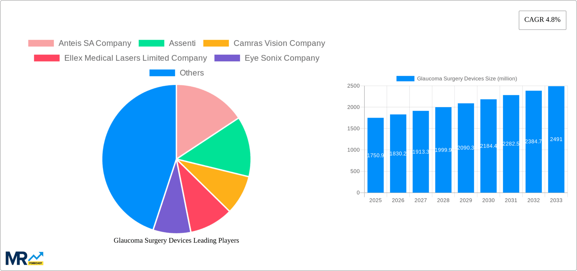 Glaucoma Surgery Devices Research Report - Market Overview and Key Insights
