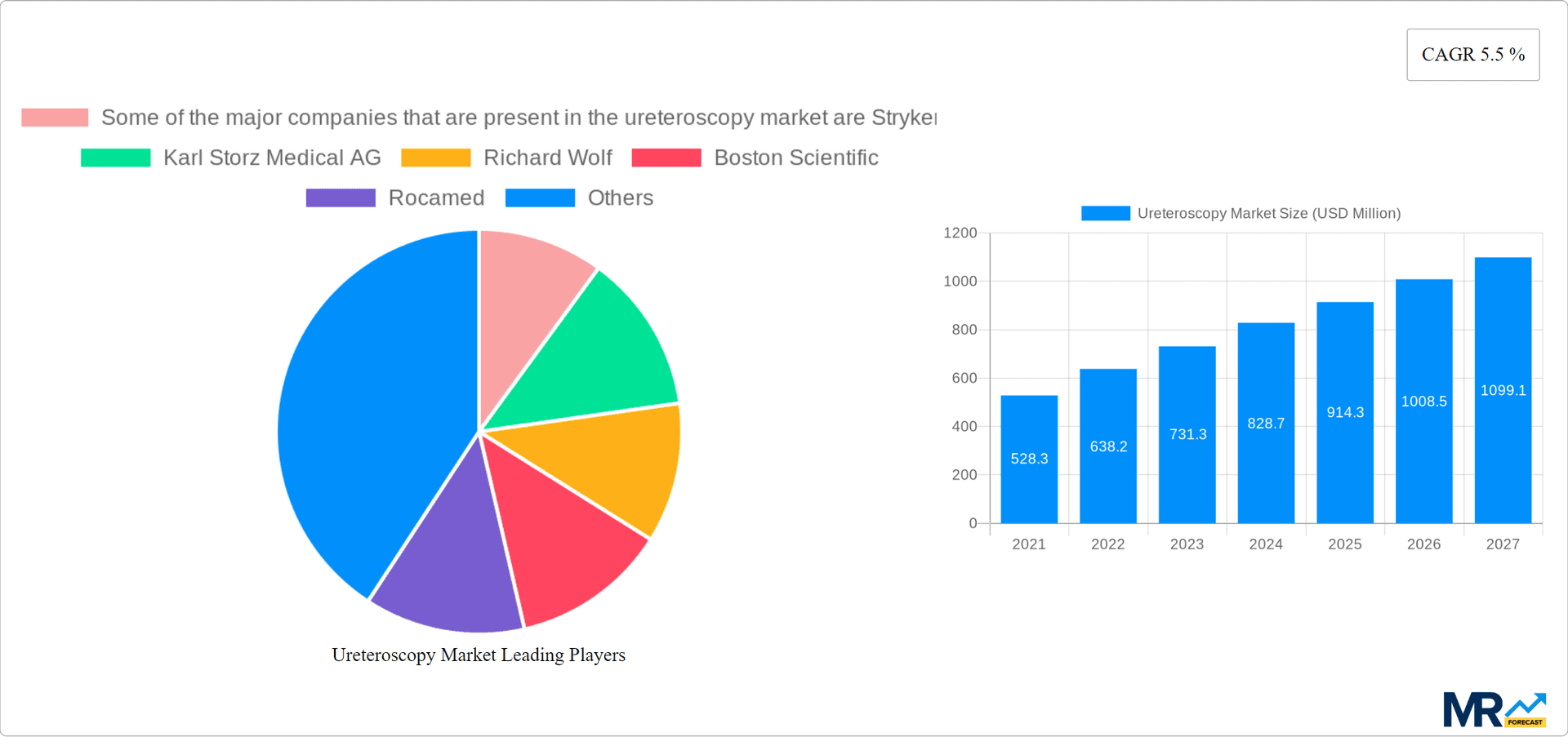 Ureteroscopy Market Research Report - Market Overview and Key Insights