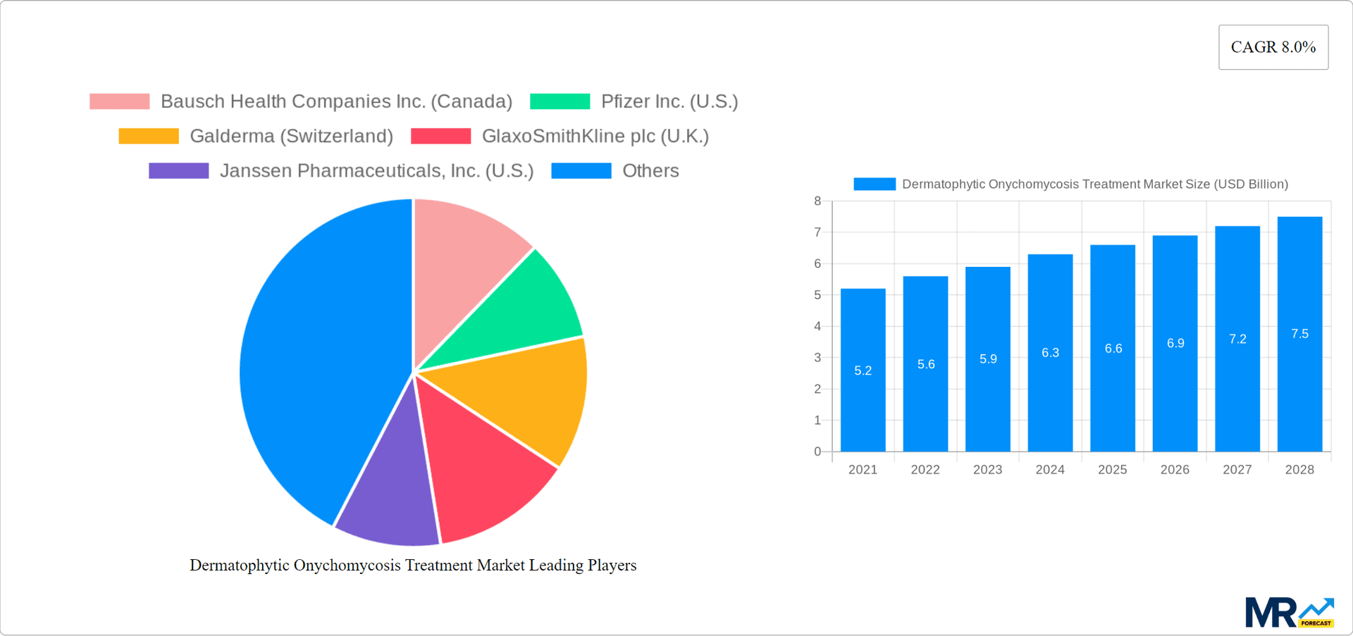 Dermatophytic Onychomycosis Treatment Market Research Report - Market Overview and Key Insights