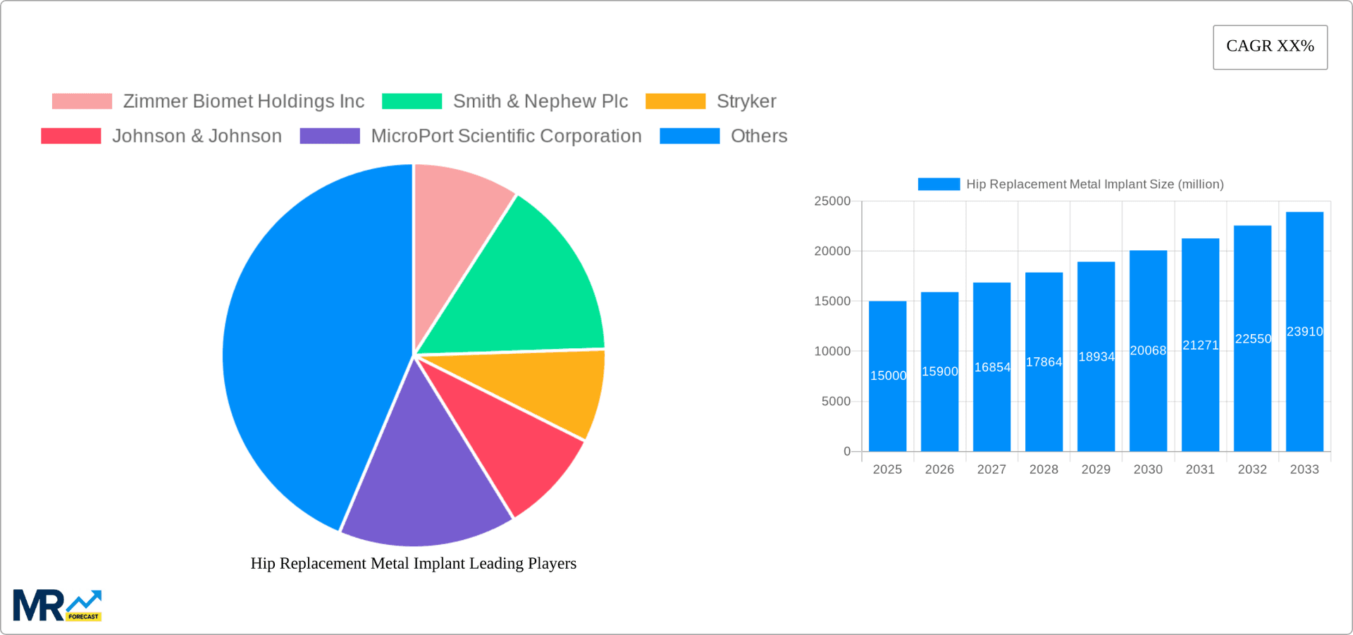 Hip Replacement Metal Implant Research Report - Market Overview and Key Insights