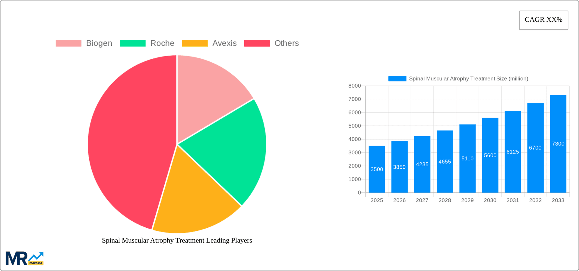 Spinal Muscular Atrophy Treatment Research Report - Market Overview and Key Insights